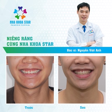 Nha khoa Star