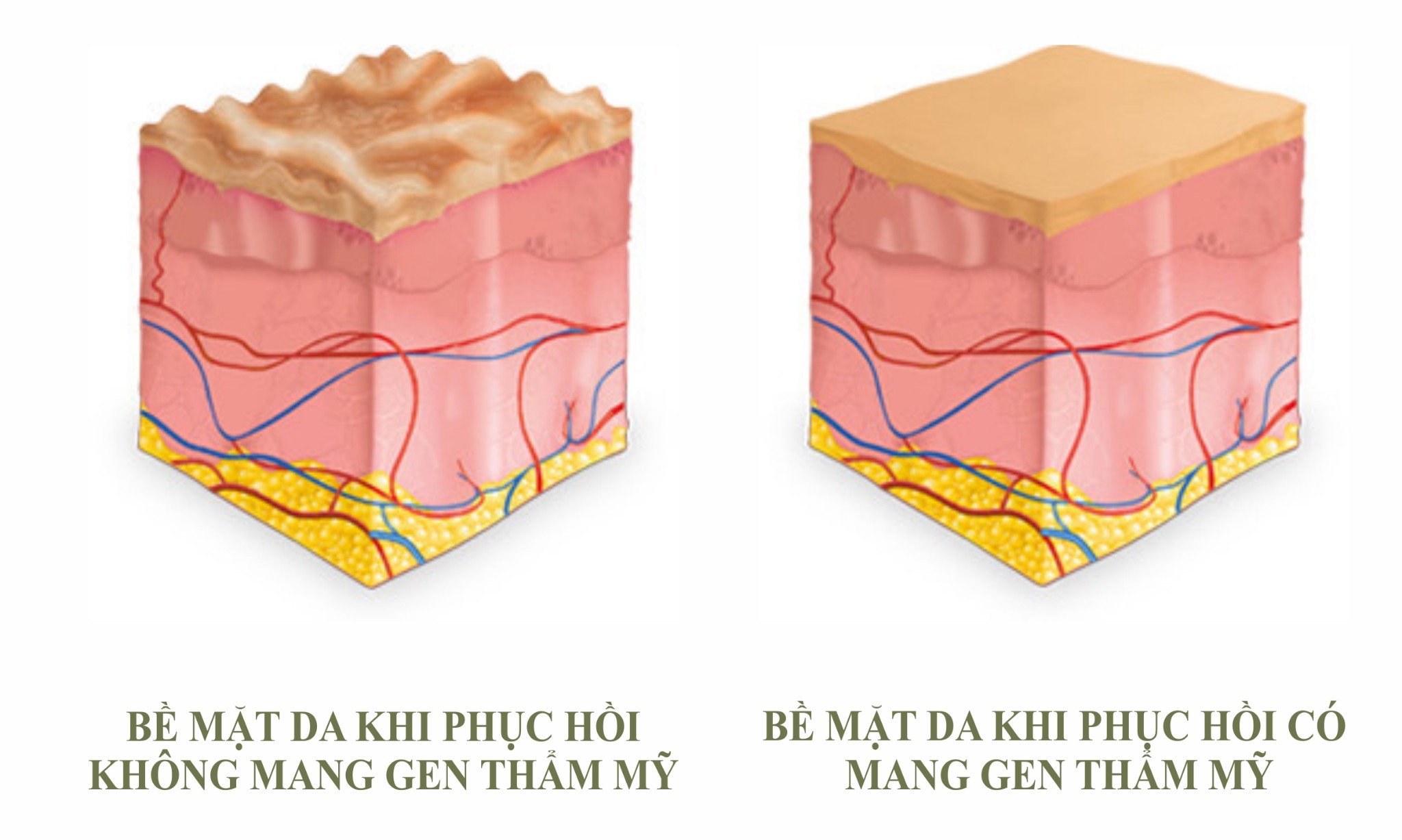 Tại sao bạn nên sử dụng quần áo gen sau phẫu thuật thẩm mỹ