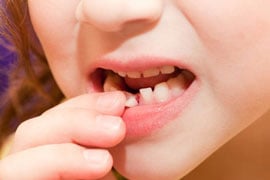 Phục hồi và làm chắc răng bị lung lay
