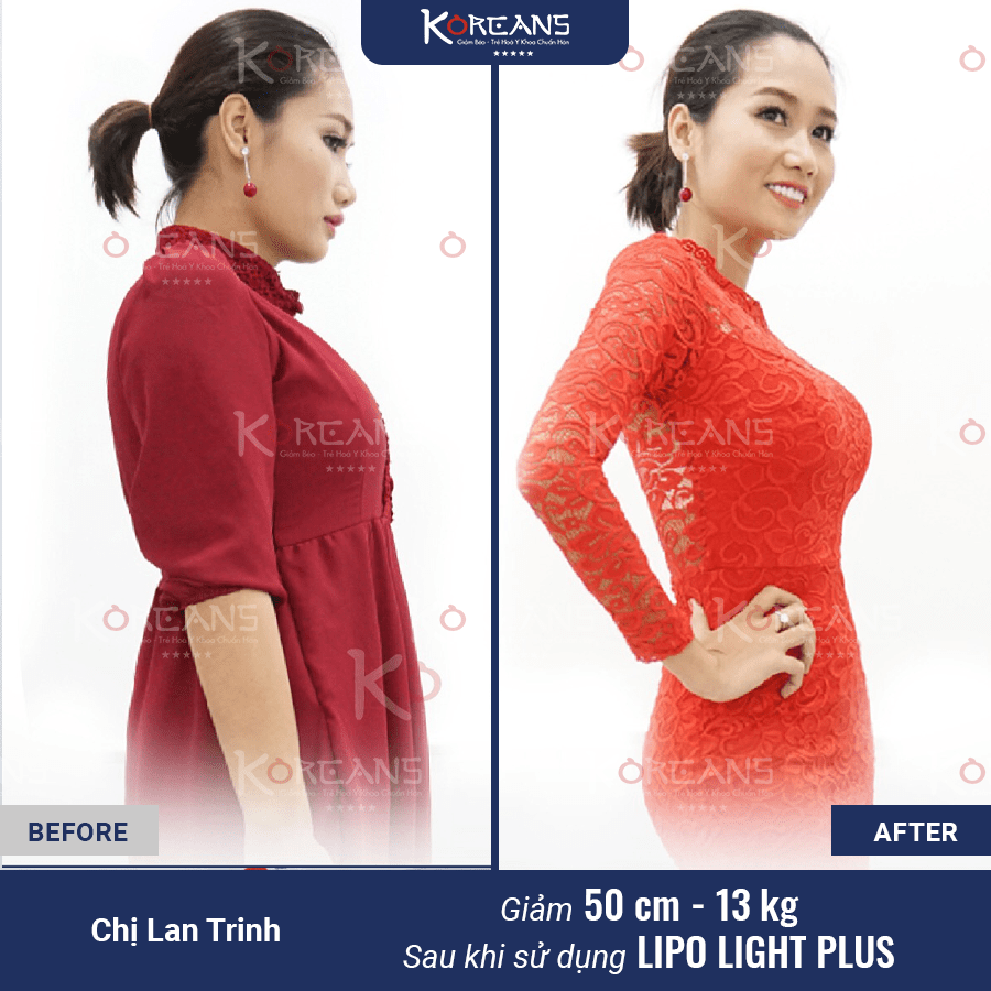 Ảnh 2_1