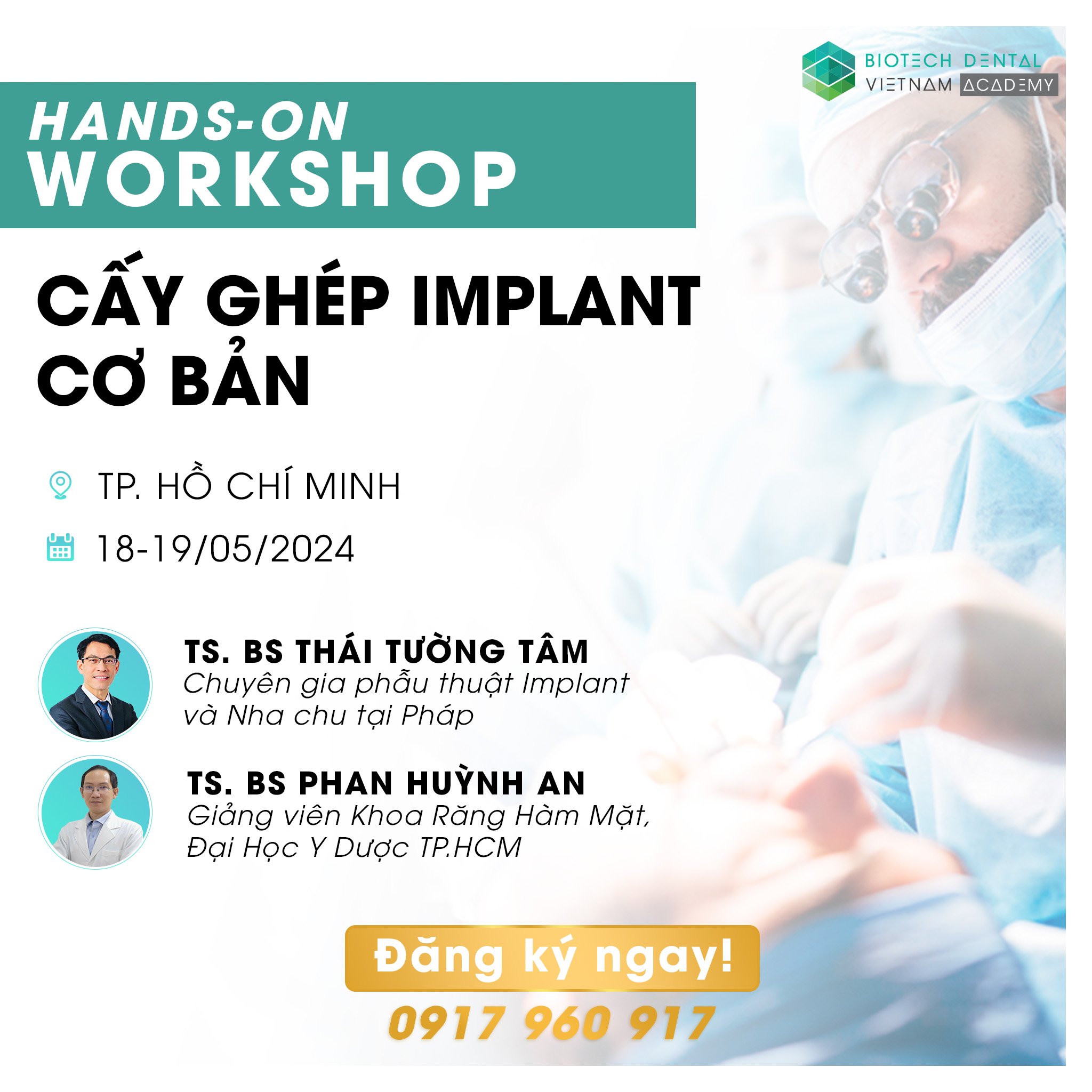 Tháng 5.2024 Hands on workshop về cấy ghép Implant