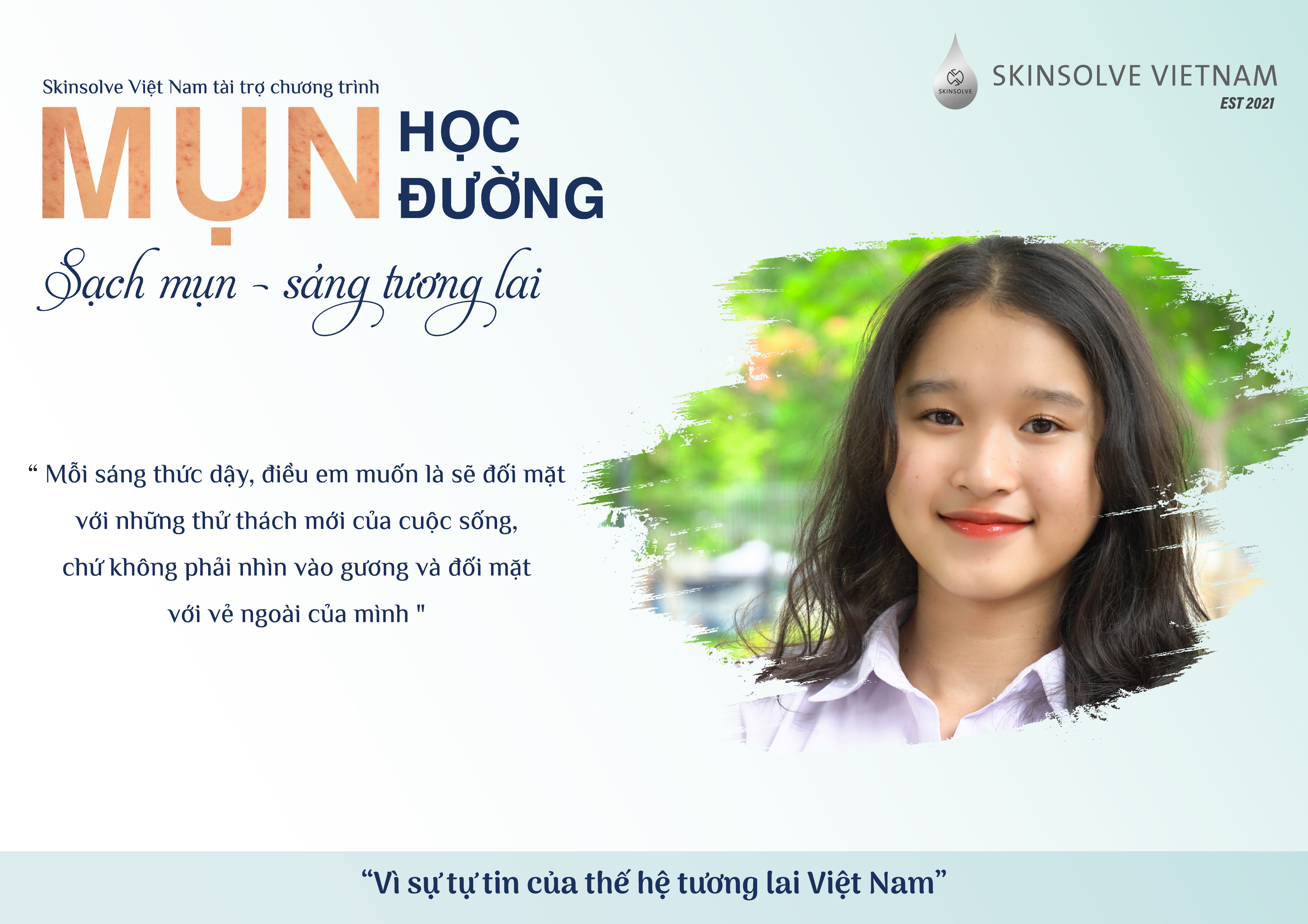Câu chuyện dự án