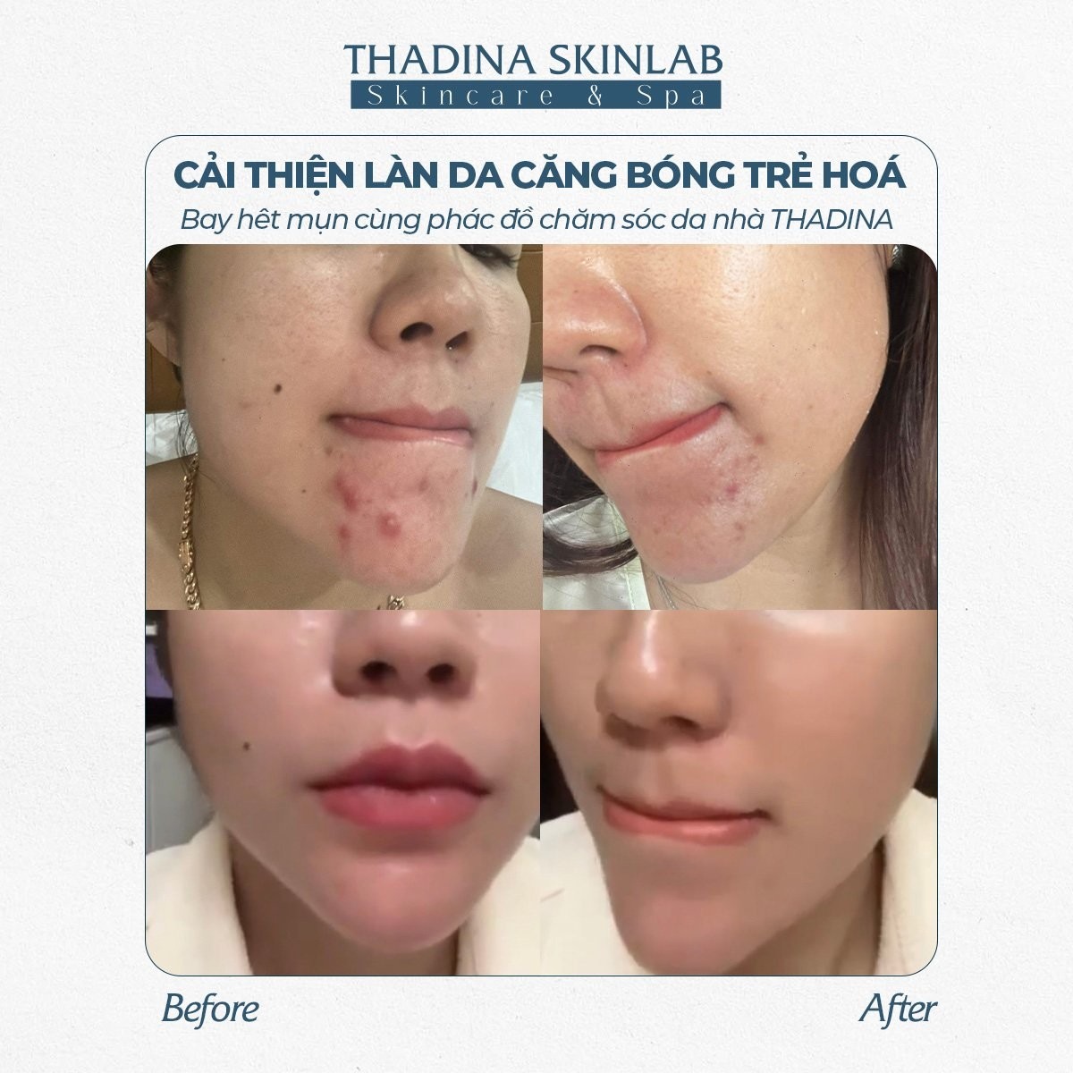 FEEDBACK KHÁCH HÀNG