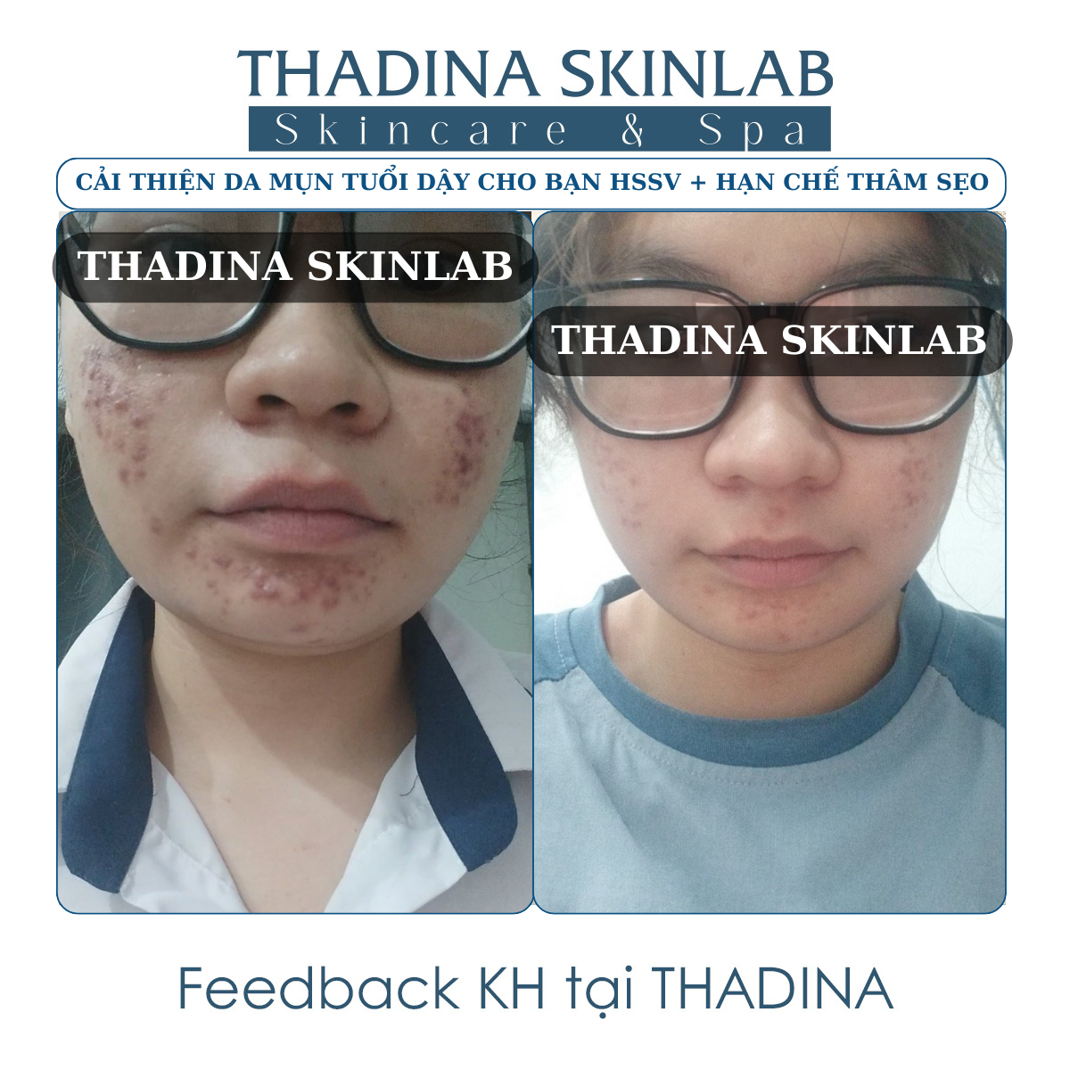 FEEDBACK KHÁCH HÀNG