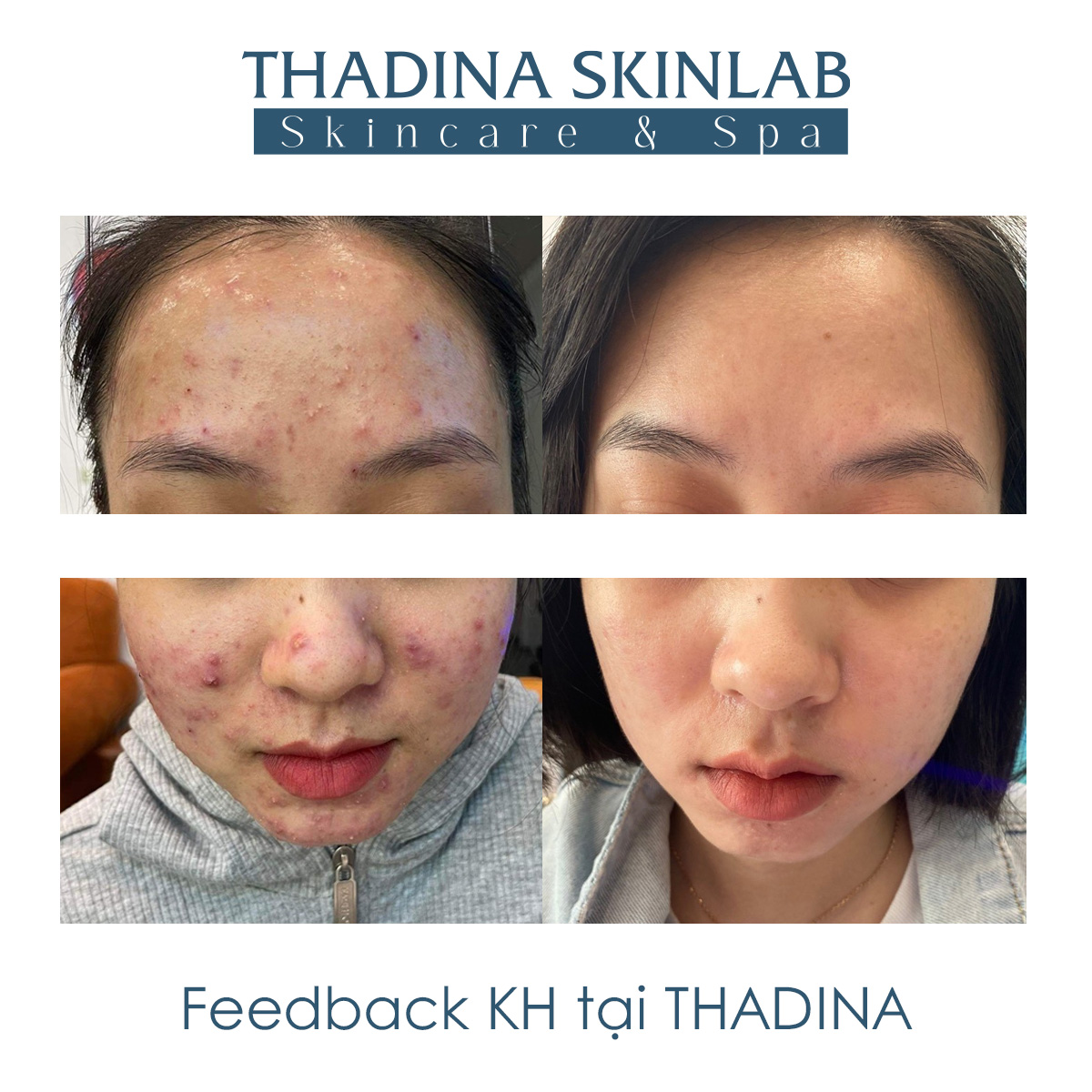 FEEDBACK KHÁCH HÀNG