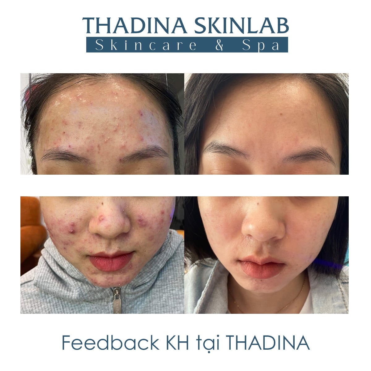 FEEDBACK KHÁCH HÀNG