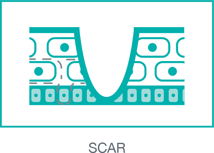 scar
