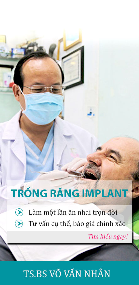 Trồng răng implant