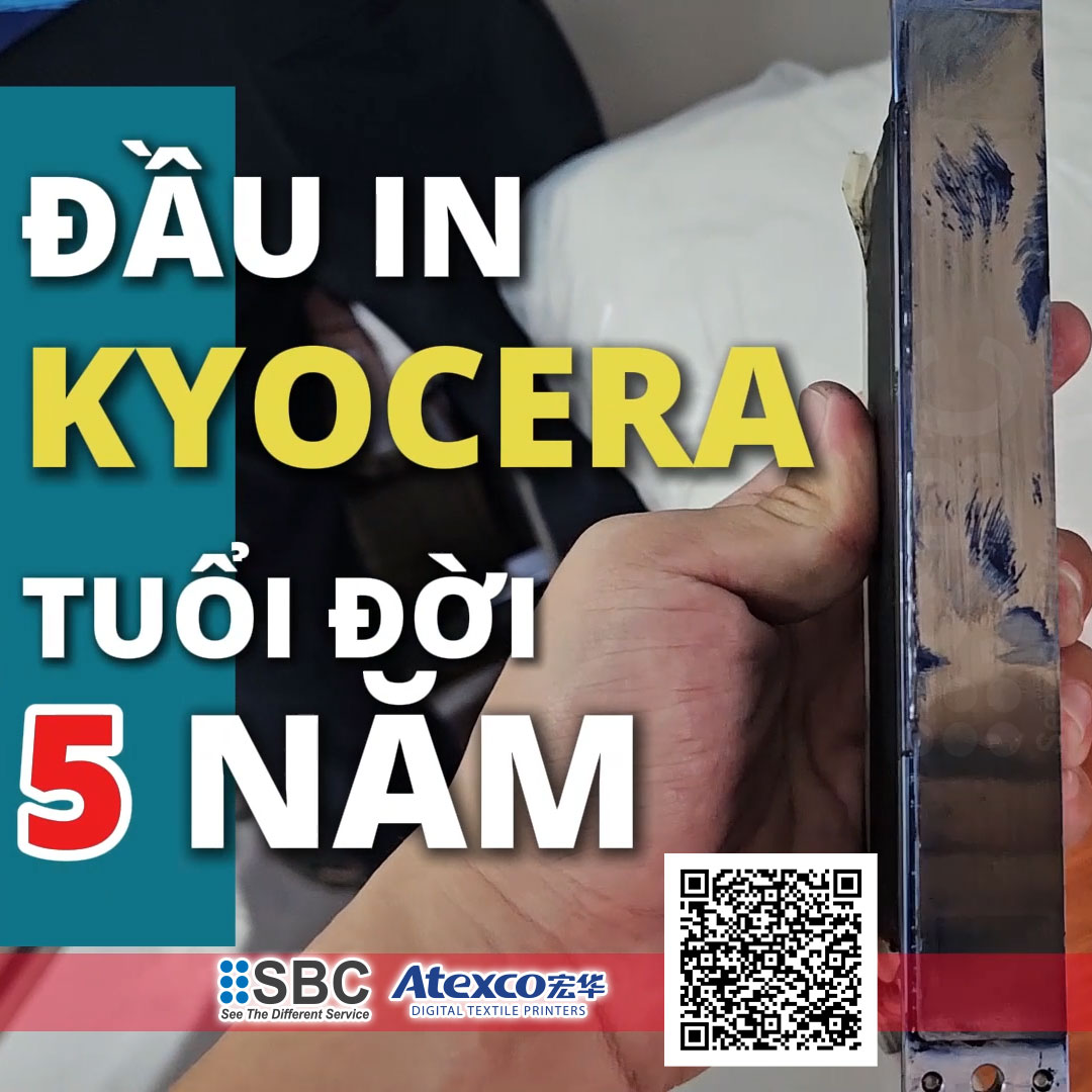 Phỏng vấn công ty SDA về Sản phẩm và dịch vụ của SBC