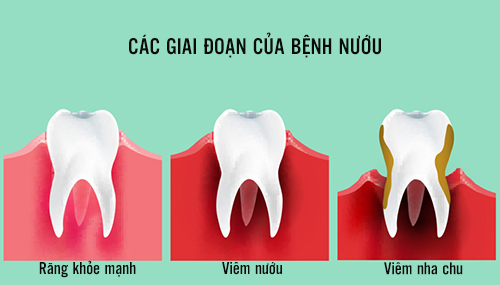 NỘI NHA TỔNG QUÁT