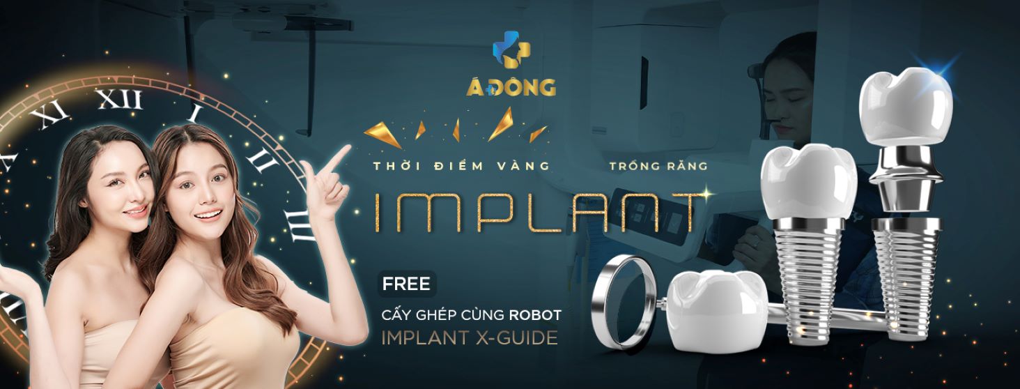 Trồng Răng Implant