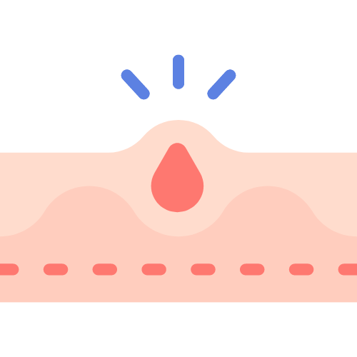 Trị Mụn Sẹo thâm