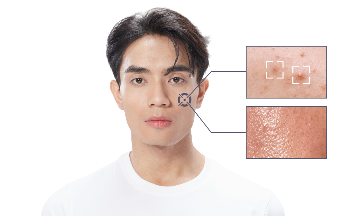 HIỂU DA NAM GIỚI