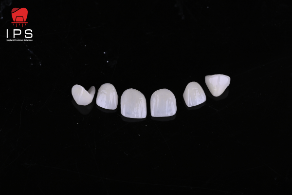 PHỤC HÌNH THẨM MỸ