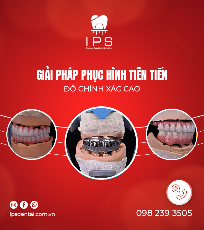 CÔNG TY TNHH GIẢI PHÁP IMPLANT NHA KHOA CHÍNH XÁC