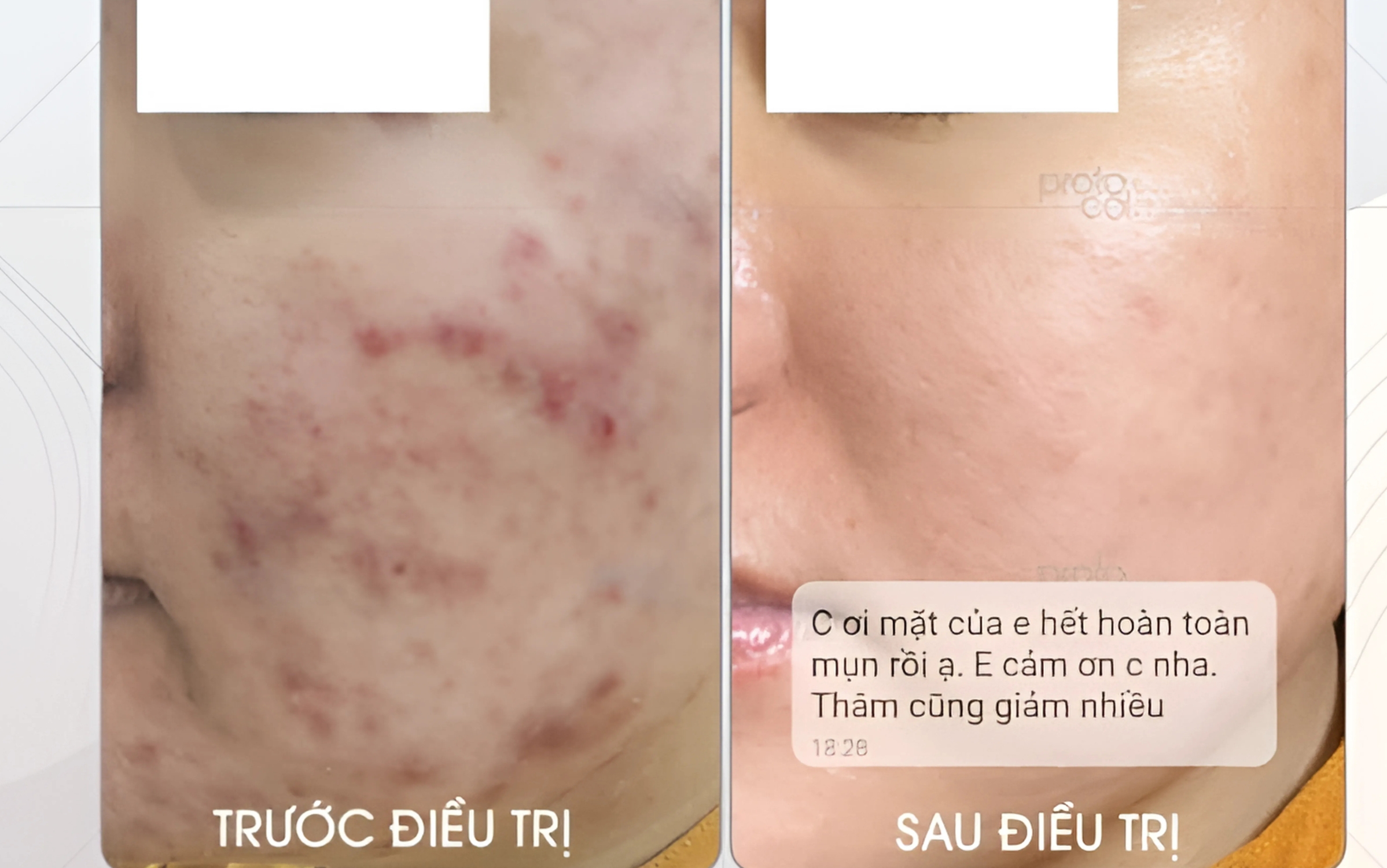 HÌNH ĐIỀU TRỊ TRƯỚC VÀ SAU